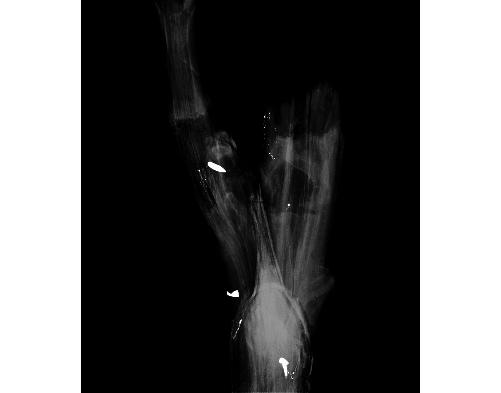 The Forest Xray