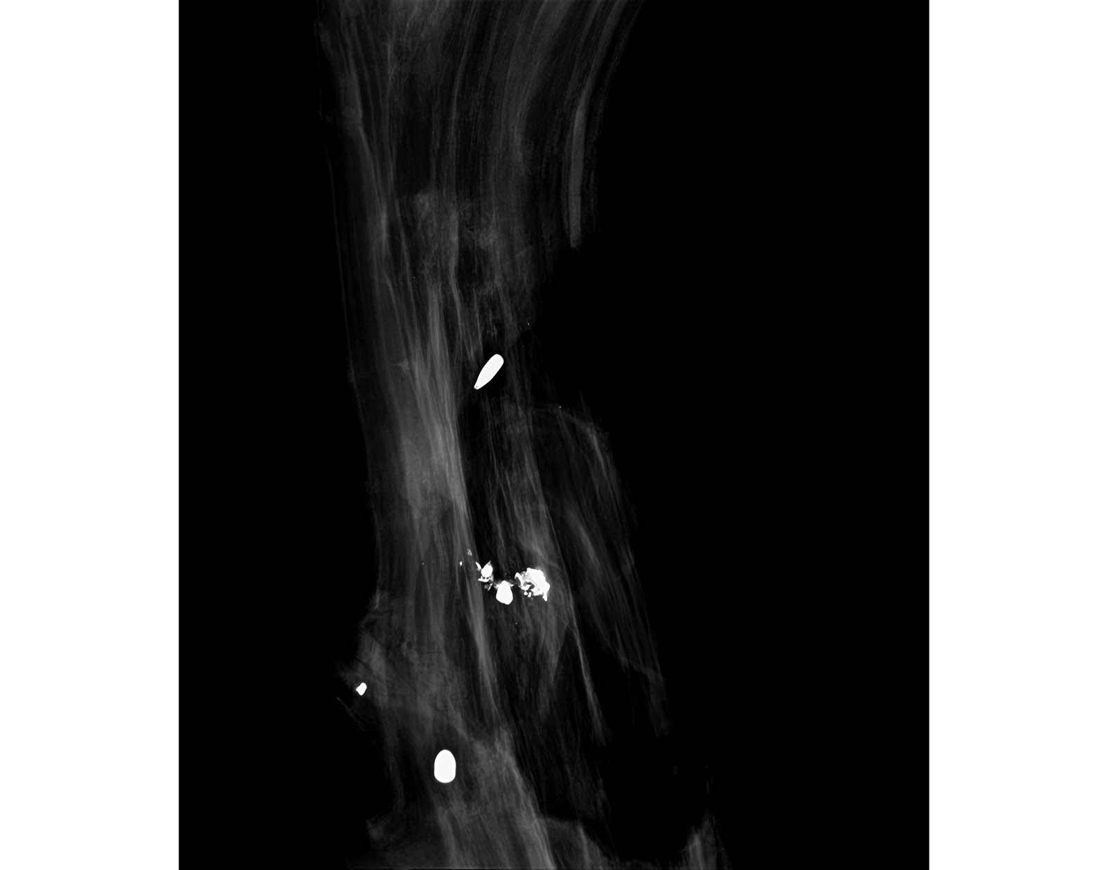 The Forest Xray
