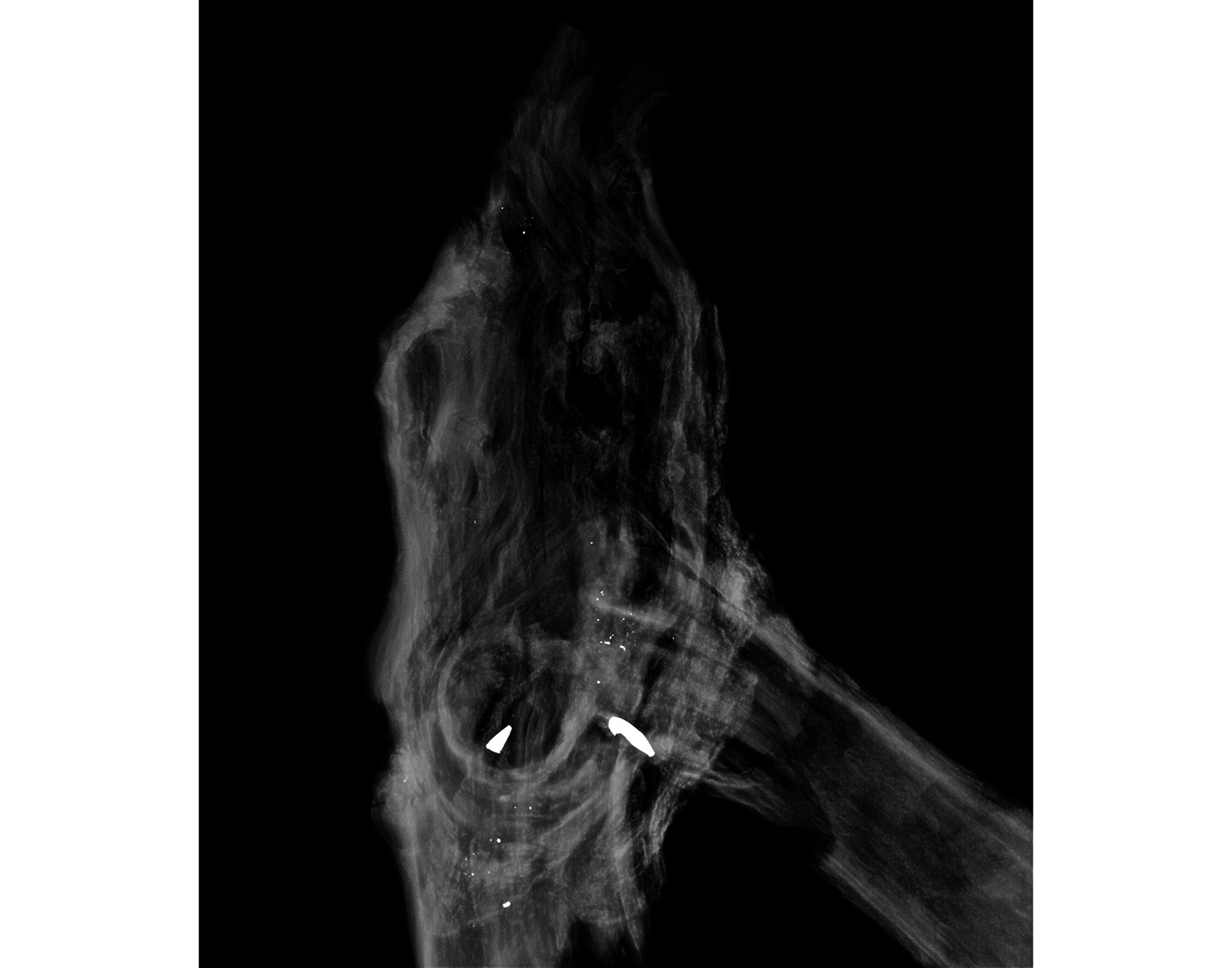 The Forest Xray