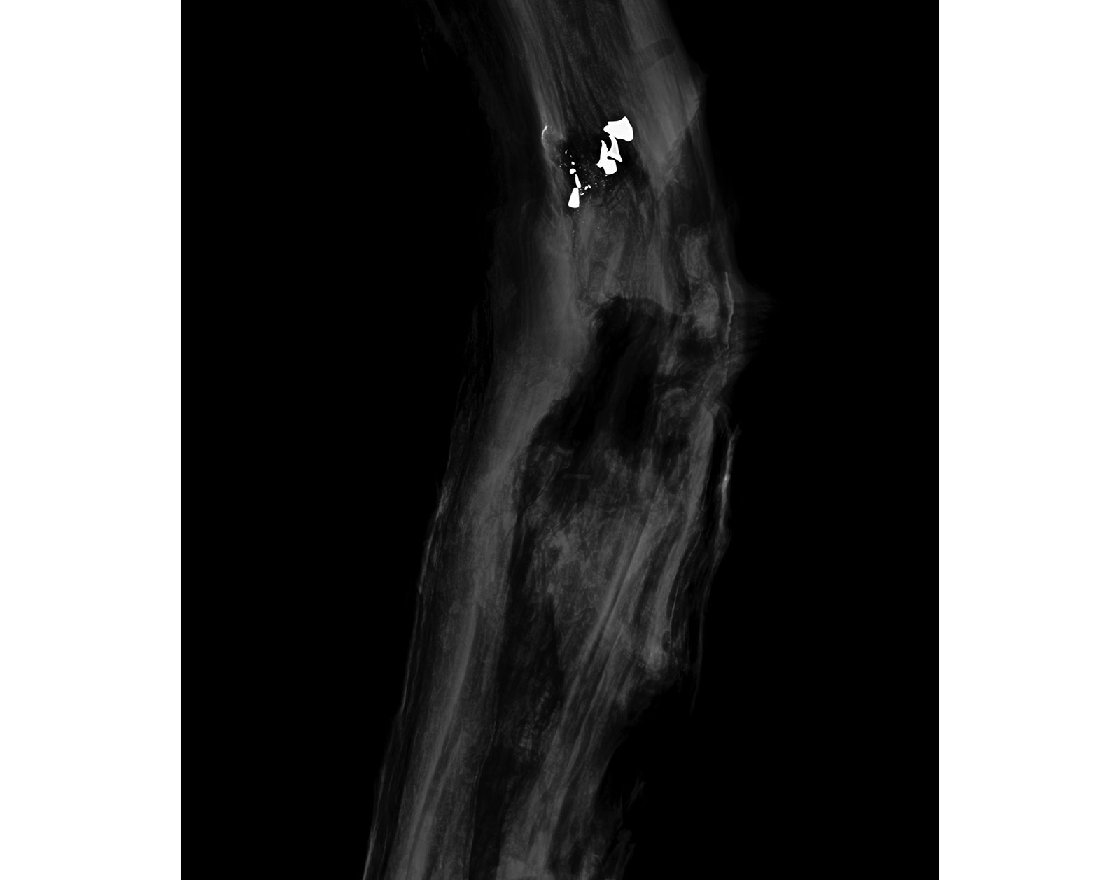 The Forest Xray
