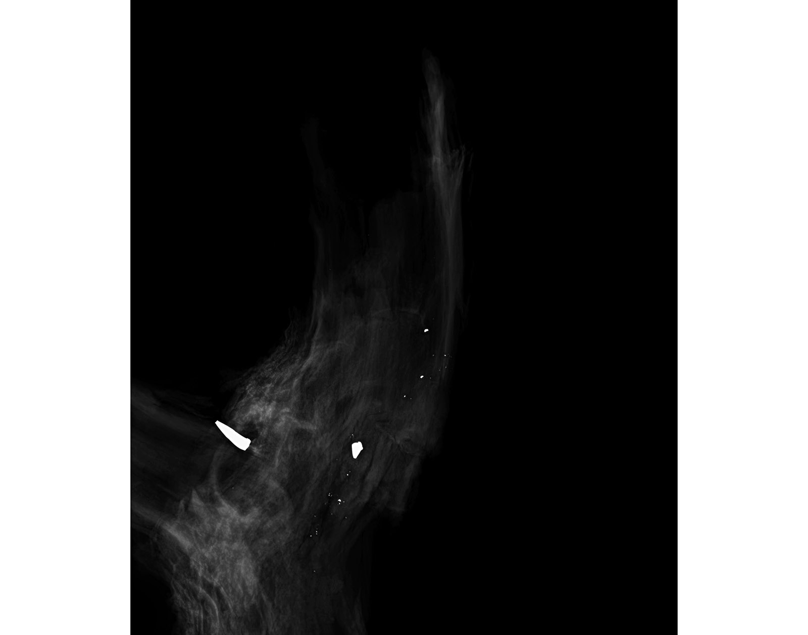The Forest Xray