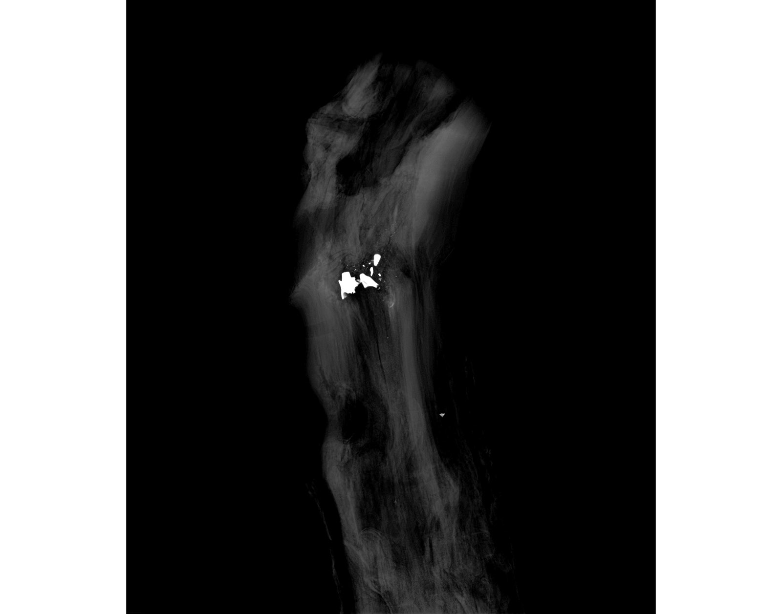 The Forest Xray