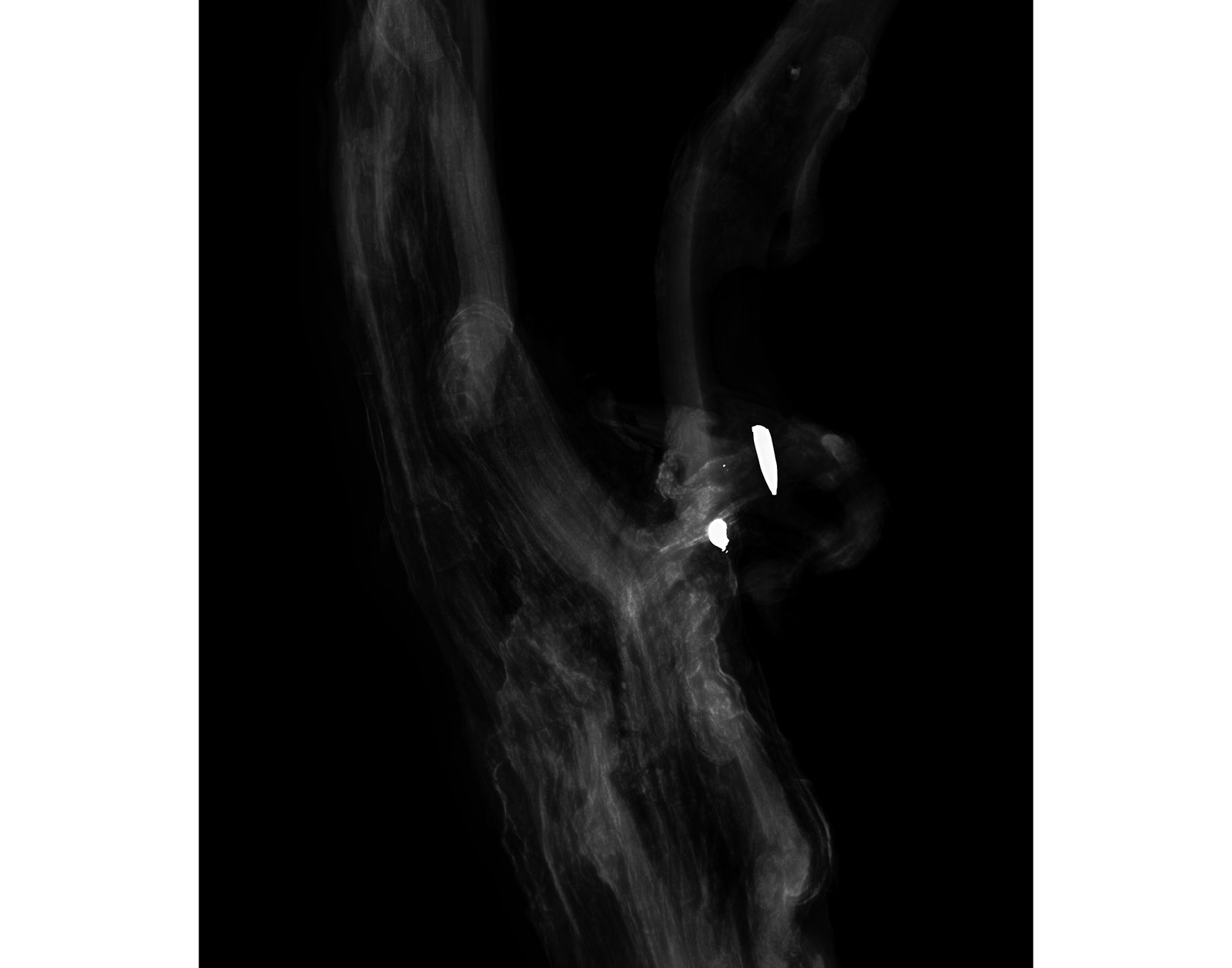 The Forest Xray