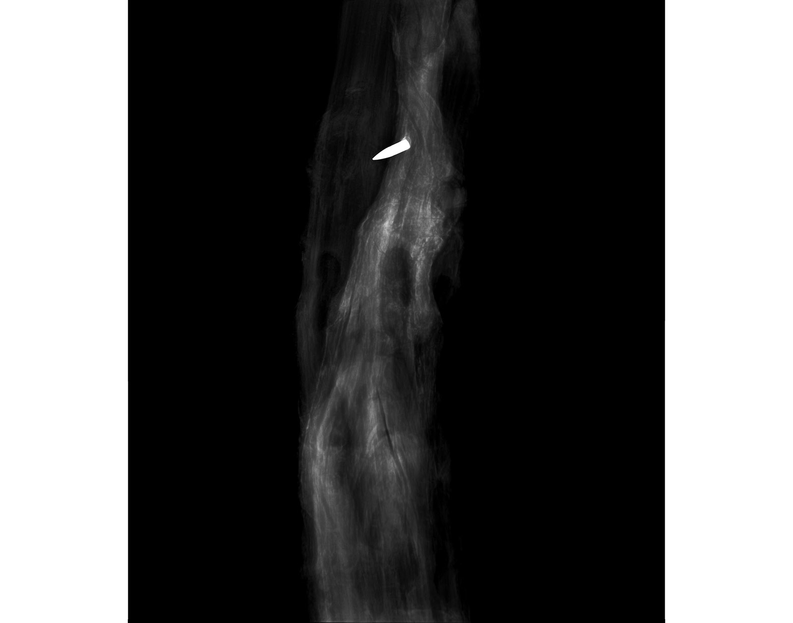 The Forest Xray
