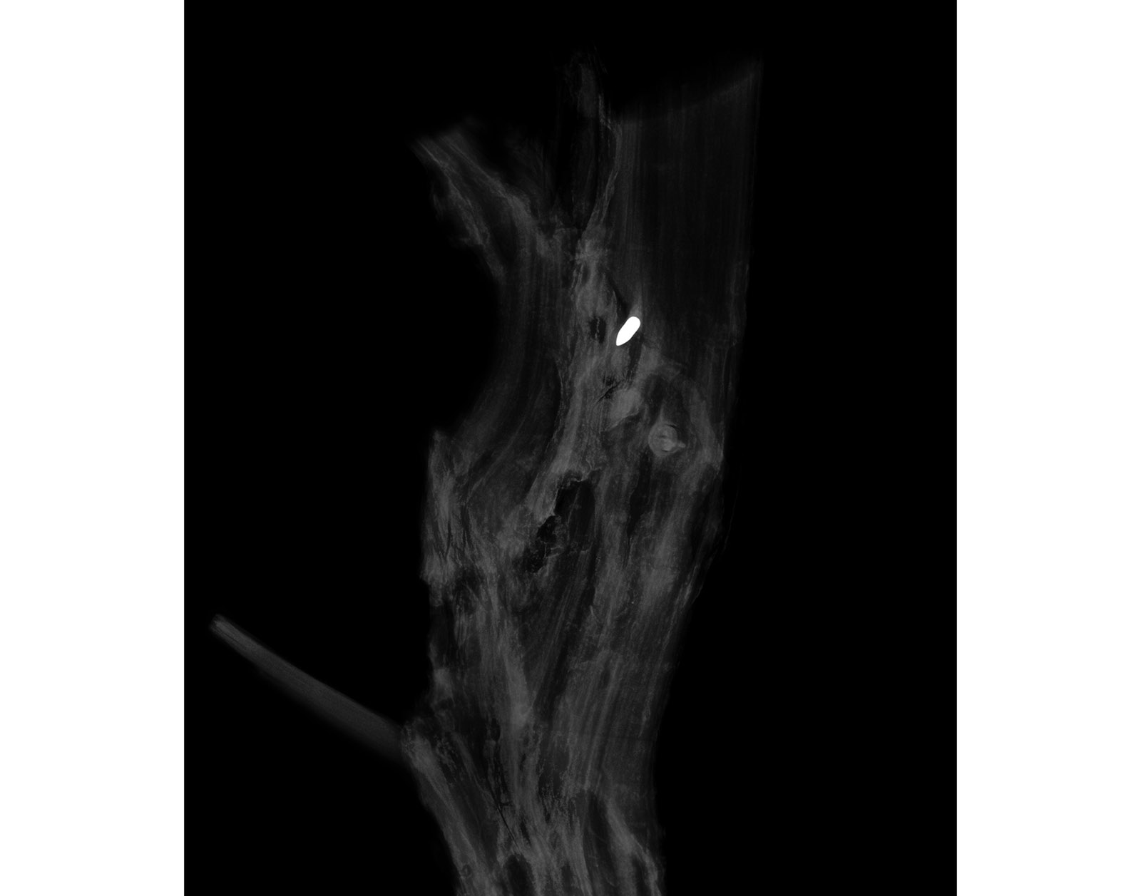 The Forest Xray