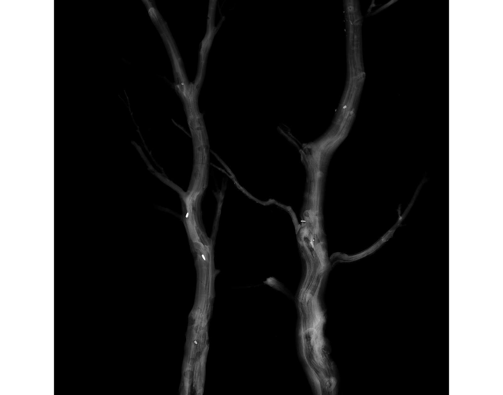 The Forest Xray